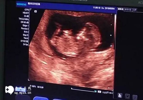 2023年徐州第一人民醫(yī)院試管嬰兒攻略，內(nèi)附成功率與費用構(gòu)成！_1