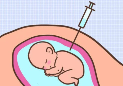 促卵泡生成素低的表現(xiàn)有哪些？通過這些可以進(jìn)行一定的治療