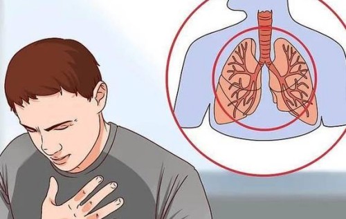 剖宮產(chǎn)后收腹帶需要戴多久？附佩戴時(shí)間及注意事項(xiàng)_1