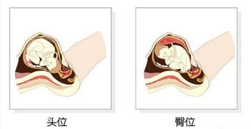 過來人分享艾灸治療月經(jīng)不調(diào)的效果，好不好一看便知