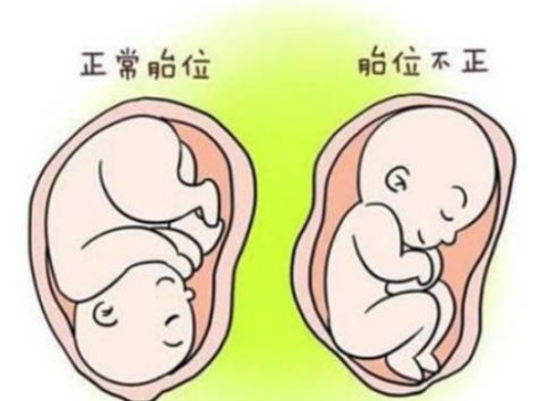 寧波助孕：三代篩查不合格仍然想要移植？能夠接受這些風(fēng)險(xiǎn)就可以繼續(xù)