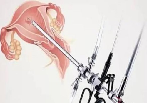 單身女性不要只看凍卵的利端，只要是手術(shù)就會(huì)有利弊