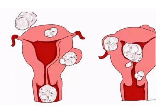寧波助孕機(jī)構(gòu)：四維彩超也能看出胎兒性別，男孩女孩有這四方面區(qū)別