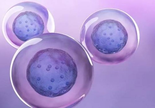 易發(fā)唐氏兒的孕婦群體，做好預(yù)防措施必不可少