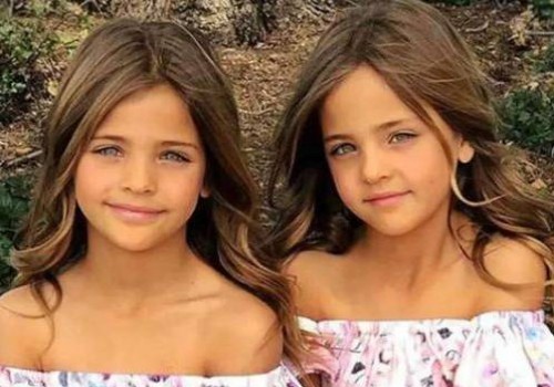 婚后檢查染色體異常堅持要孩子可能會有什么樣的后果-