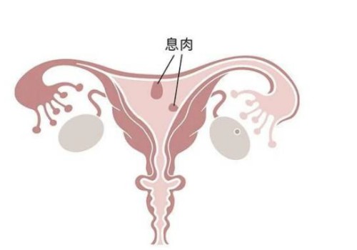 寧波正規(guī)助孕機(jī)構(gòu)：睪丸越多生育能力越強(qiáng)不可信，多睪癥有什么危害