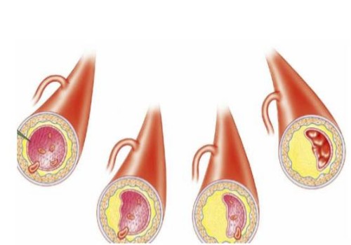 寧波供卵試管：超詳細的試管嬰兒移植全流程分享，從開始到成功只需要五步